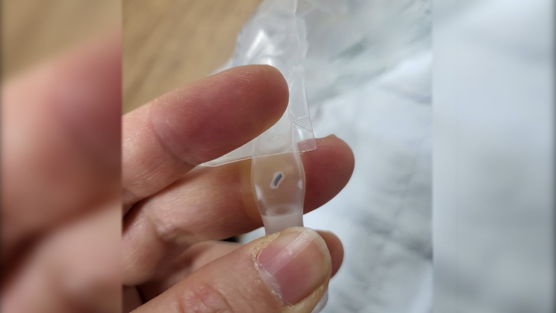수액에서 '이물질'.. 병원은 