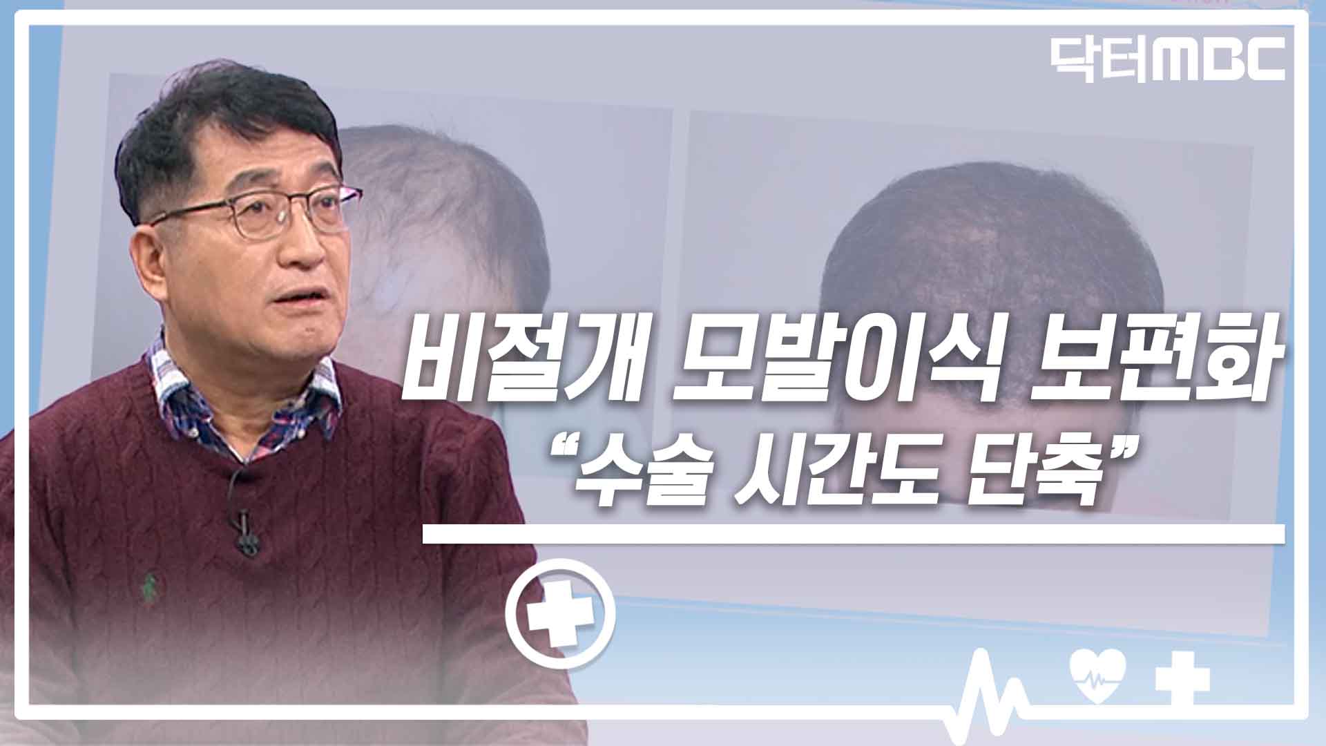 [닥터M] 비절개 모발이식 보편화.. 