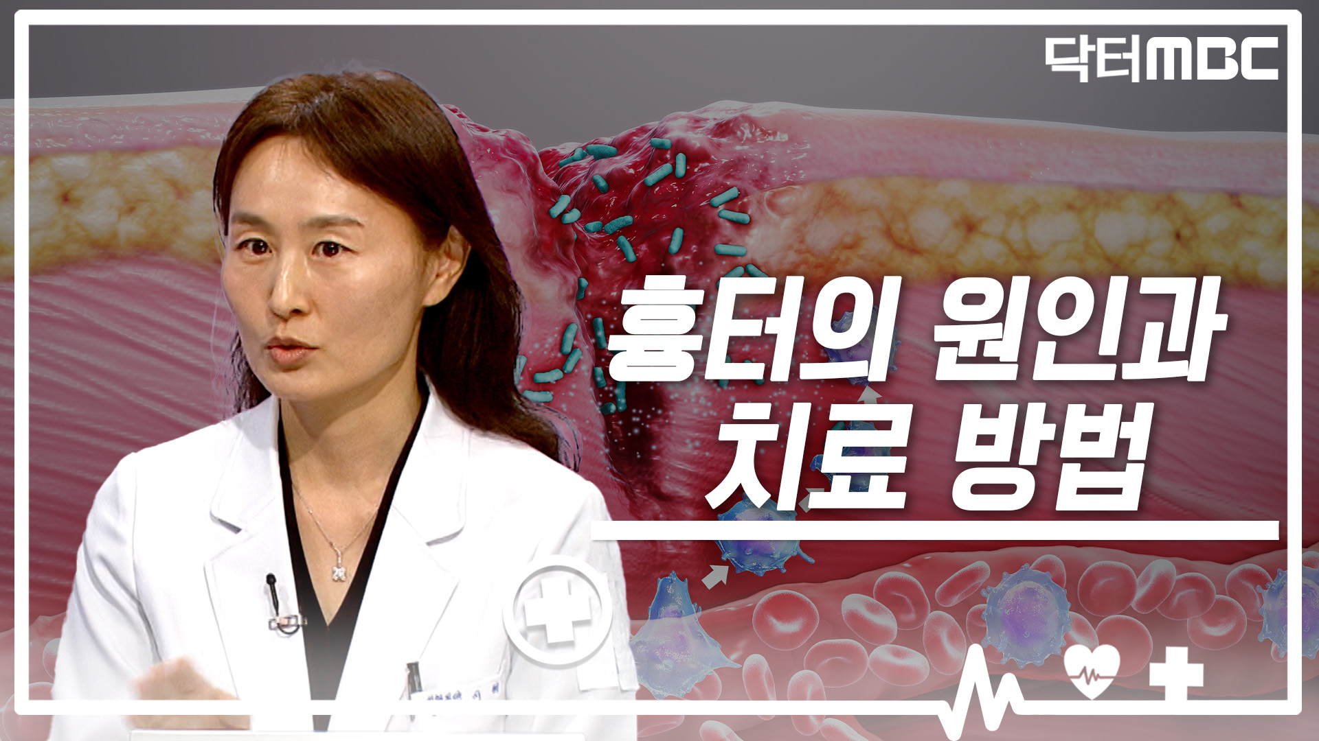 [닥터M] 흉터의 원인과 치료방법